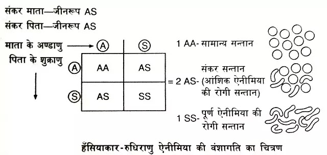 सिकल सेल एनीमिया या हंसियाकार-रुधिराणु ऐनीमिया(Sickle-cell Anaemia) |hindi