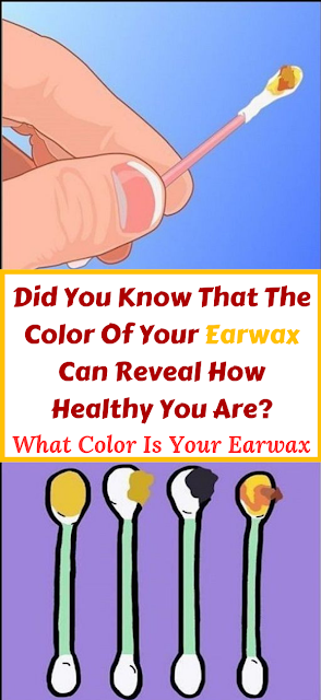 The Color And Texture Of Your Earwax Reveals Everything About Your Health