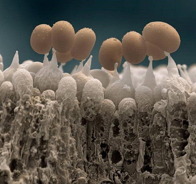 Виды плесени под микроскопом