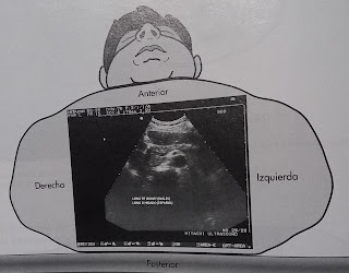 Ultrasonido_diagnostico_longitudinal_higado