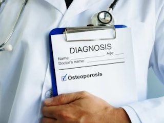 Tips Terhindar Dari Osteoporosis dan Memiliki Tulang Kuat