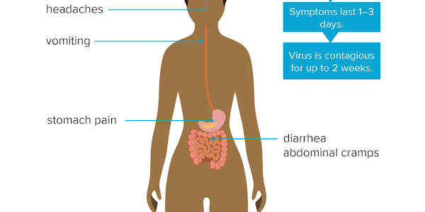 Norovirus cases detected in Kerala : Norovirus : Current Affairs : Science and Technology