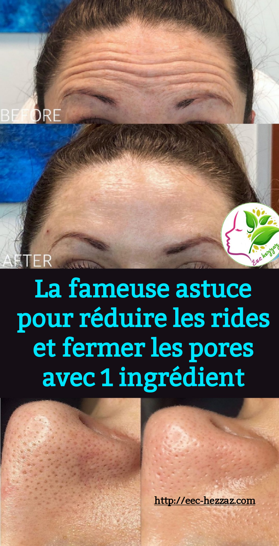 La fameuse astuce pour réduire les rides et fermer les pores avec 1 ingrédient