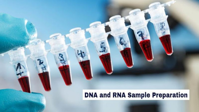 DNA and RNA Sample Preparation Market