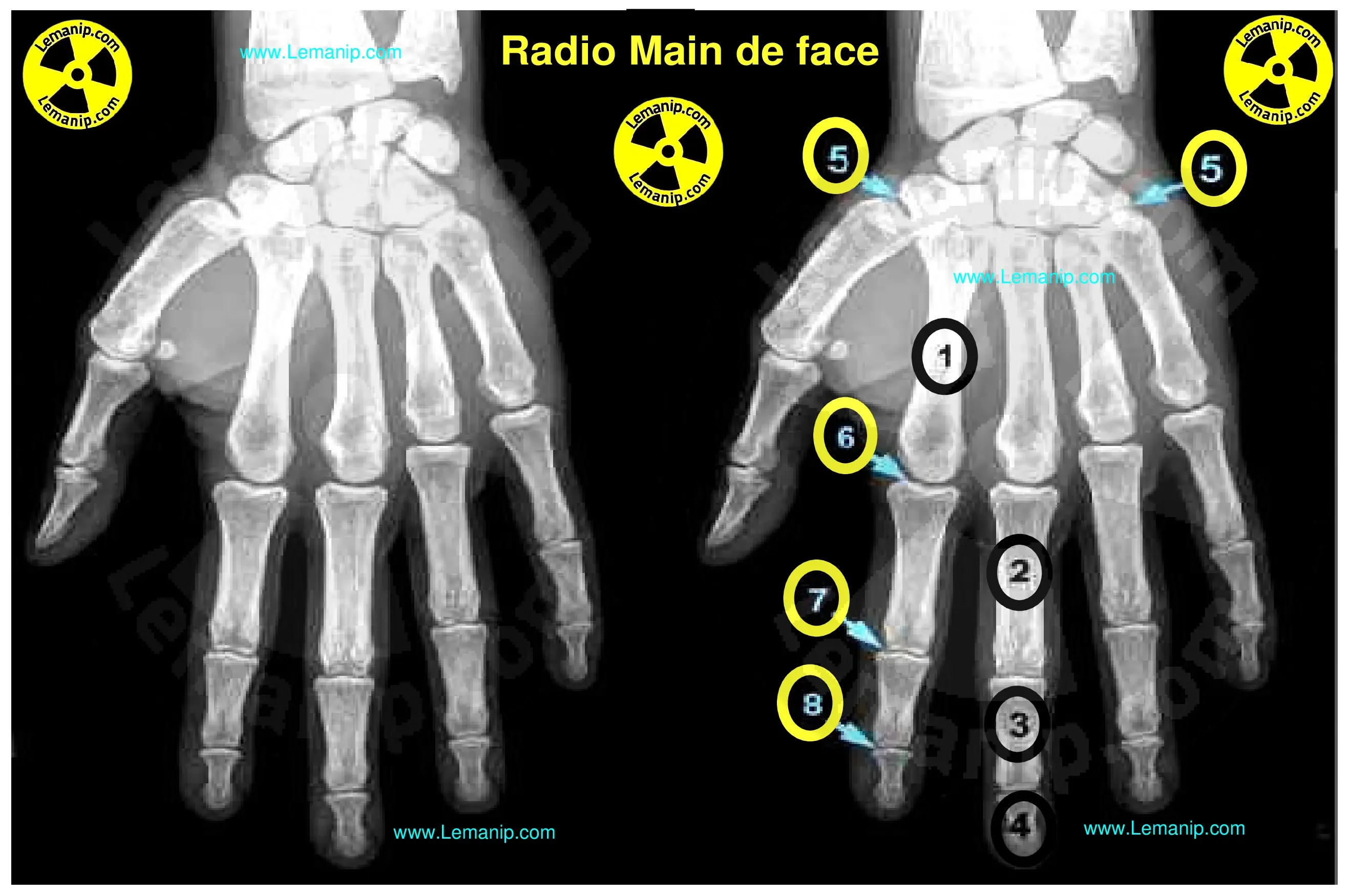 hand specialist near me,hand surgeon near me,hand doctor,hand doctor near me,water main,hand orthopedic,hand surgeon,orthopedic hand specialist near me,main man,orthopedic hand specialist