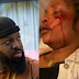 Timaya arrested after being accused of hit-and-run incident that left woman bleeding in a hospital