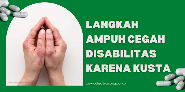 cegah-disabilitas-karena-kusta