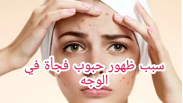طرق علاج ظهور الحبوب في الوجه بشكل مفاجئ