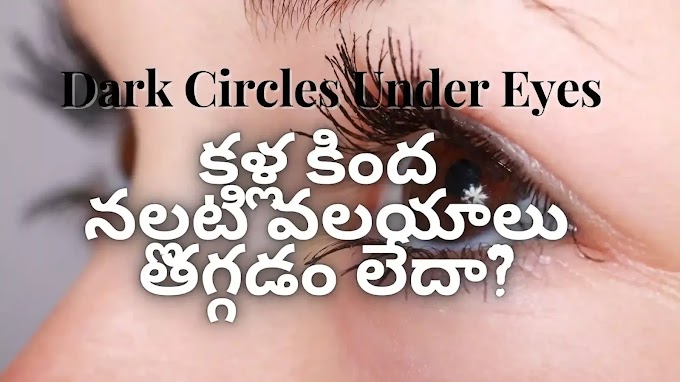 Dark circles(కళ్ల కింద) Under eyes(నల్లటి వలయాలు) | health tips Telugu కళ్ల కింద నల్లటి వలయాలు తగ్గడం లేదా?