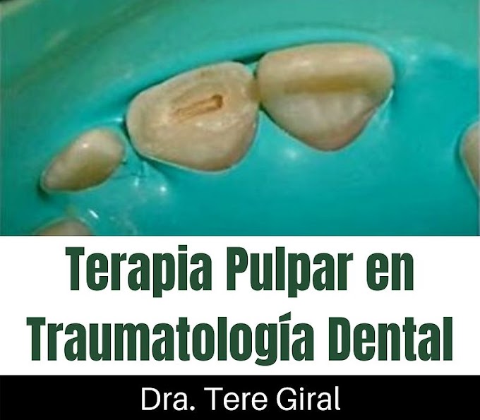 WEBINAR: Terapia Pulpar en Traumatología Dental - Dra. Tere Giral