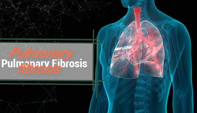 Pulmonary fibrosis, symptoms and causes