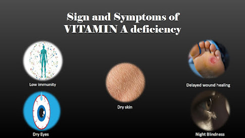 5 Sign and symptoms of vitamin A deficiency, low immunity, delayed wound healing, dry eyes, dry skin, night blindness