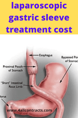 treatment like a gastric sleeve can be expensive to manage