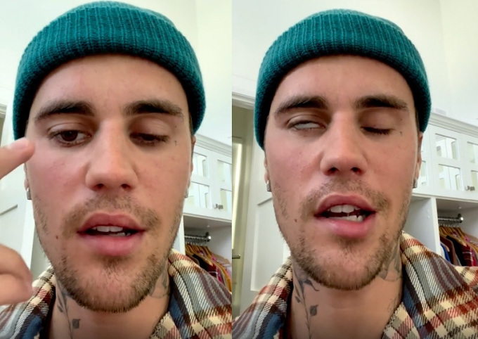 I Know This Storm Will pass, But In The Meantime, Jesus is with me - Justin Bieber Speaks on Struggle With Facial Paralysis