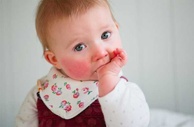 Penyebab Munculnya Bintik Merah Pada Kulit Bayi dan Cara Menanganinya