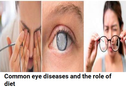 Common eye diseases and the role of diet | Today Latest health Tips&Tricks by www.Mixchar.com