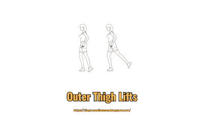 Outer Thigh Lifts