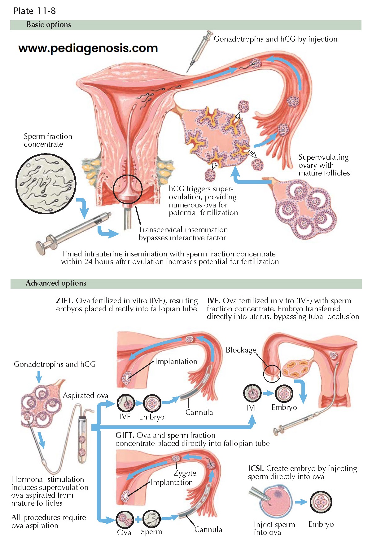 ASSISTED REPRODUCTION