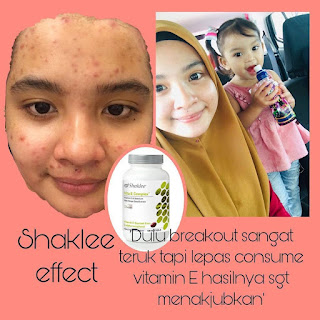 Testimoni Review Vitamin E Shaklee Untuk Wanita dan Lelaki