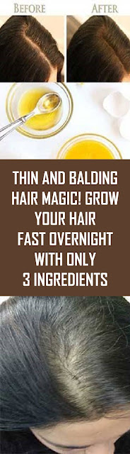 Thin and Balding Hair Magic! Grow Your Hair Fast Overnight With Only 3 Ingredients