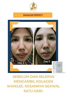 Kebaikan, Harga, Review Testimoni Collagen Powder Shaklee