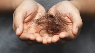 Learn about the causes of hair loss