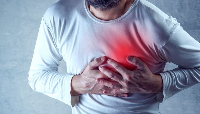 Dynapharm supplements that can treat Angina