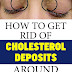 How To Remove The Cholesterol Deposits Around Your Eyes