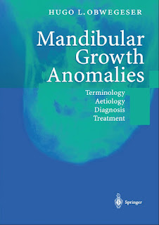 Mandibular Growth Anomalies Terminology Aetiology Diagnosis