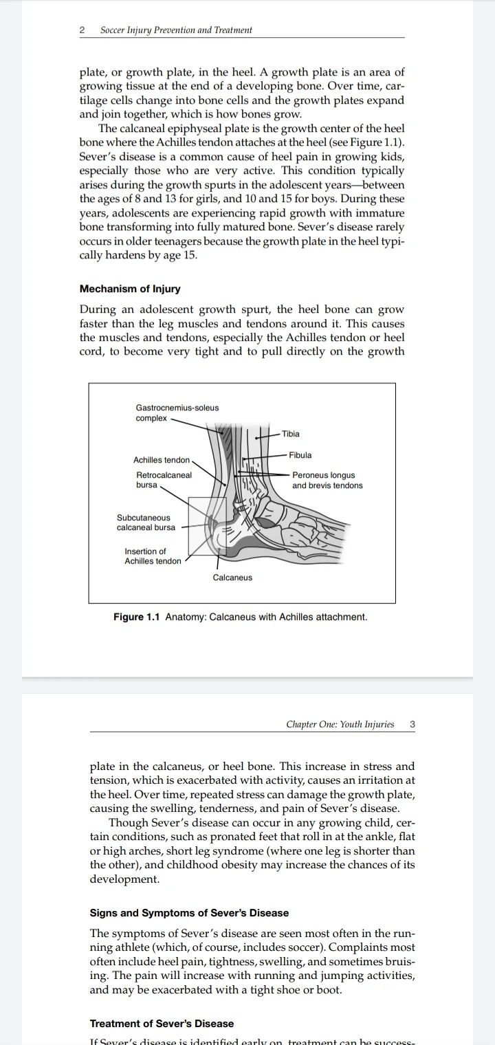 Soccer injury prevention and treatment