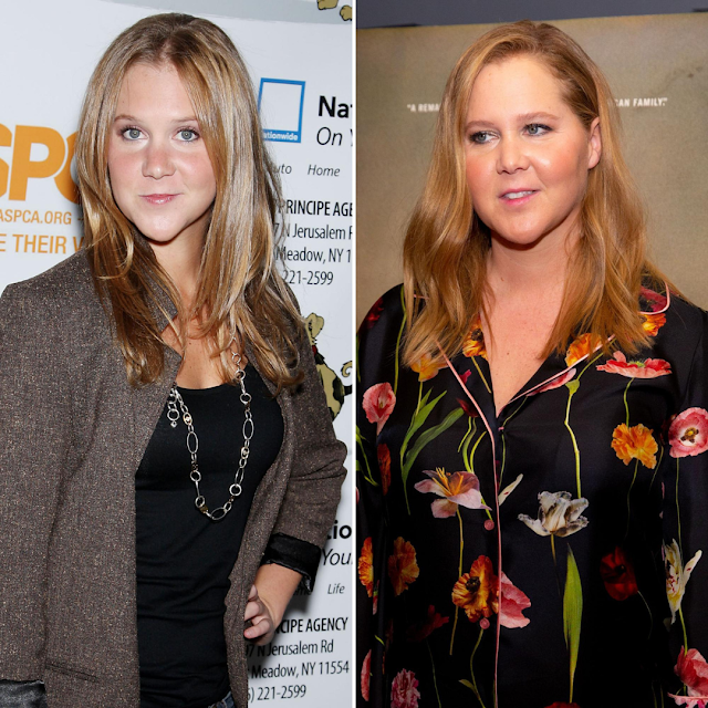 AMY SCHUMER