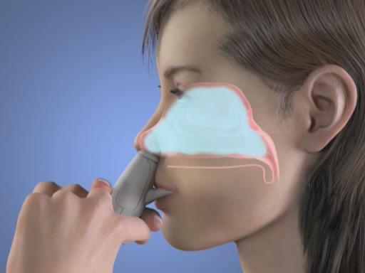 Global Nasal Drug Delivery Market Development, Growth, Trends, Demand, Analysis and Forecast 2027