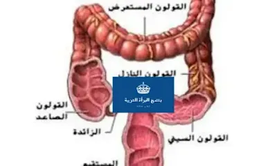 متلازمة القولون العصبي