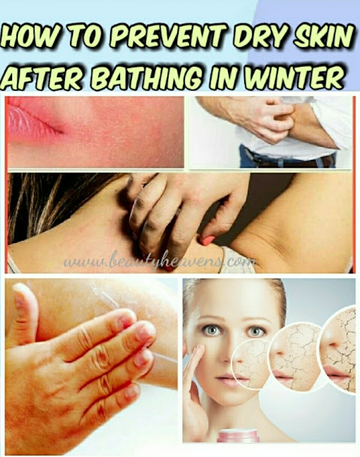 How to prevent dry skin after bathing in winter?