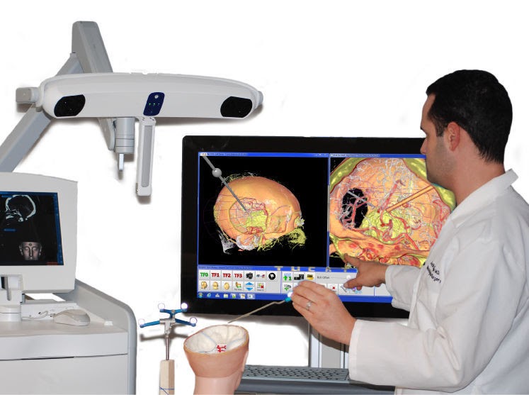 Global Surgical Navigation System Market was Worth US$ 673.1 Million, and it is Predicted to Grow at a CAGR of 6.9% Over the Forecast Period (2018–2026)