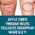 Apple Cider Vinegar Helps Cellulite Disappear Magically!