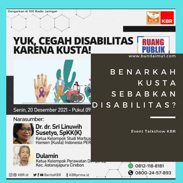 Cegah disabilitas karena kusta