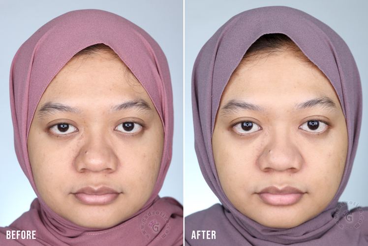 Hasil Pemakaian AVOSKIN Your Skin Bae Vitamin C