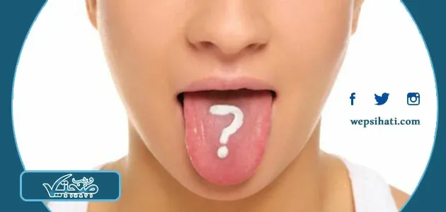 تشقق اللسان: أسبابه، أعراضه، وكيفية علاجه