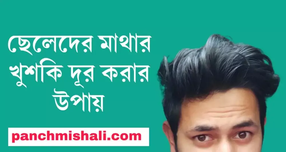 ছেলেদের মাথার খুশকি দূর করার উপায়