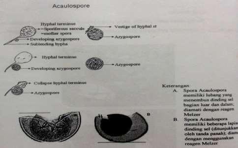 Acaulospora