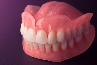 Dentures are prosthetic devices that are designed to replace lost teeth and are supported by the oral cavity's soft and hard tissues.