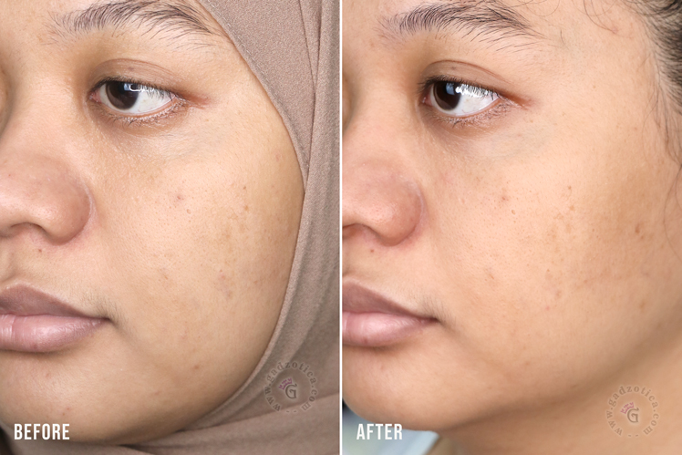 Hasil Pemakaian RESET THE SKIN