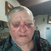 Gérard, 70 ans, tabassé et menacé de mort par un squatteur multirécidiviste, qui a pris possession de son domicile