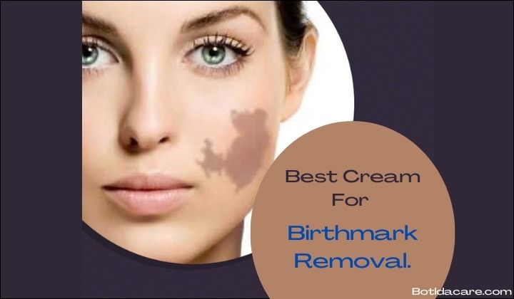 Best Cream For Birthmark Removal.