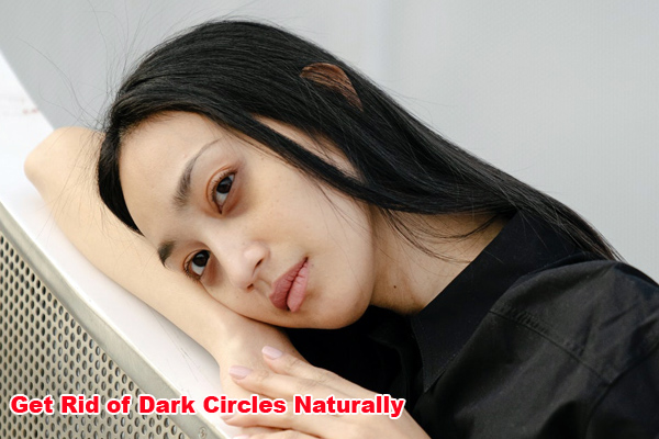 How To Get Rid of Dark Circles Naturally