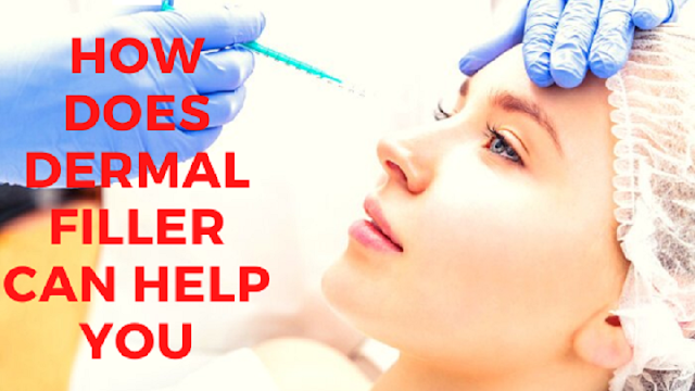 How Does Dermal Filler Can Help You?