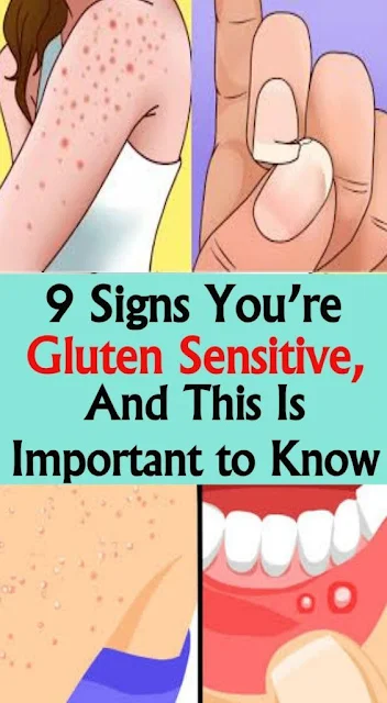 9 Signs That You May Have A Gluten Intolerance Or Sensitivity