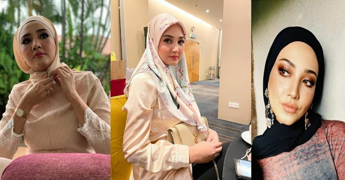 Muka Berubah, Netizen Dedah Fatiya Latif Guna 'Filler' Untuk Tampil Lebih Cantik