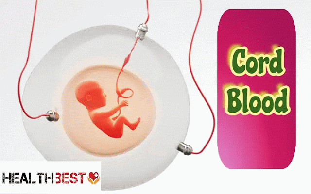 What You Should Know About Cord Blood Banking